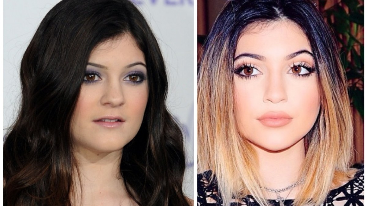 Kylie Jenner anksčiau (2011-ųjų vasarį) ir dabar (2014-ųjų balandį) / „Scanpix“/AFP ir „Instagram“ nuotr.