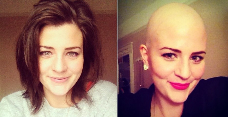 Laura Cannon prieš chemoterapiją ir po jos / lauralouiseandhernaughtydisease.blogspot.co.uk nuotr.