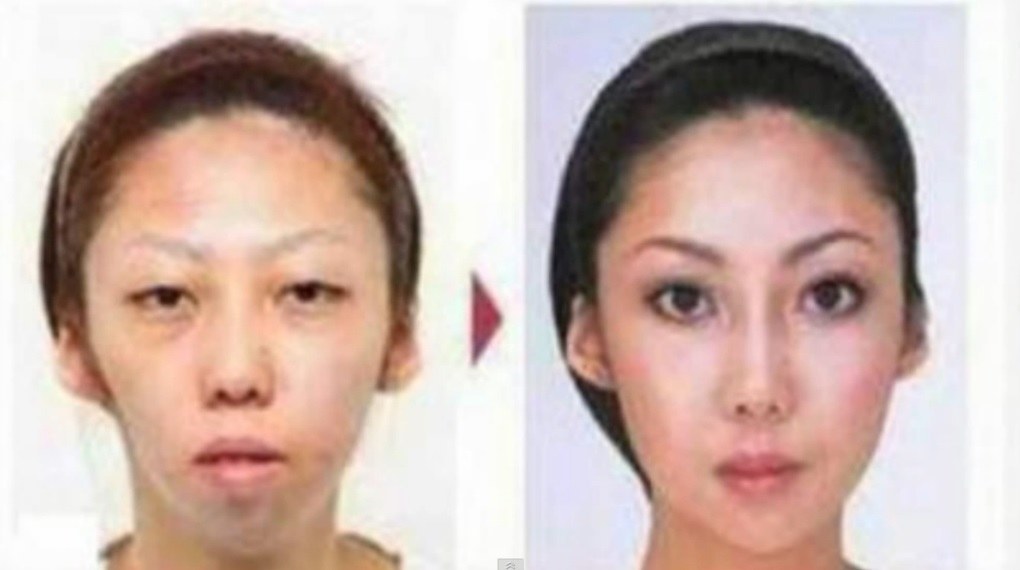 Jian Fengo žmona prieš ir po plastinių operacijų / Kadras iš „Youtube“